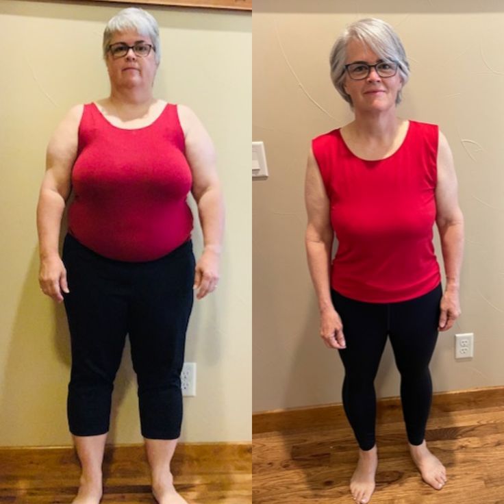Orgella Original™ Lymphatic Drainage Drops